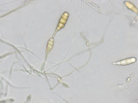 Alternaria_cucumerina_D45203_2_lq.jpg