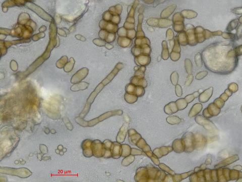 Alternaria_cucumerina_D52977-1_LQ.jpg