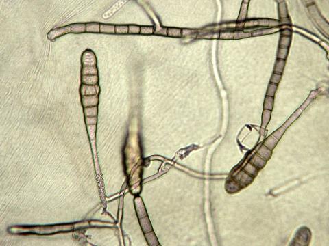 Alternaria_porri-02_LQ