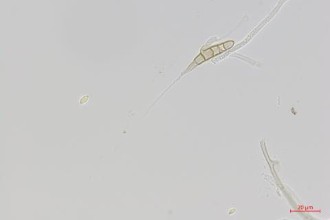 Alternaria_rostrum_D46202-1_LQ.jpg