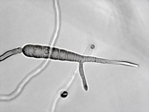 Alternaria_solani-04_LQ