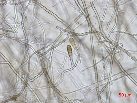 Alternaria_solani_D35066_lq.jpg