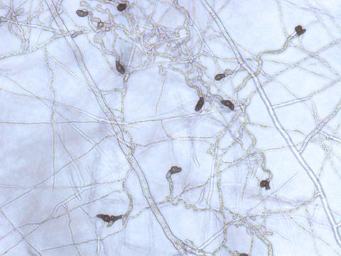 Colletotrichum_Appressoria_D50604-2_LQ