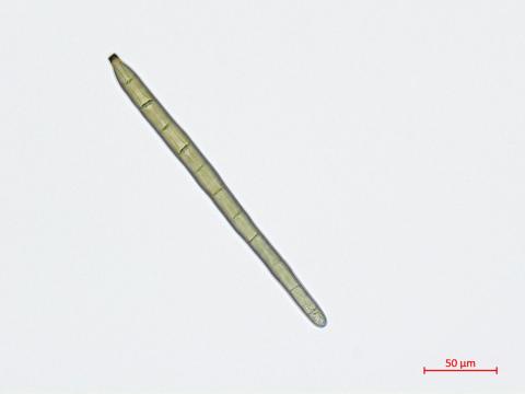 Corynespora_cassiicola_D55060-2_Conidie_LQ