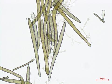 Corynespora_cassiicola_D55060-3_Conidie_LQ