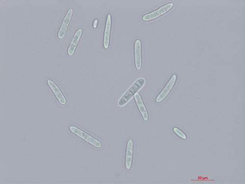 Cylindrocarpon_D27080-1_LQ