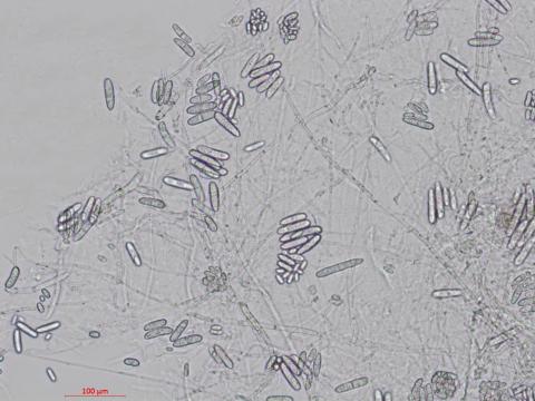 Cylindrocarpon_D27080-2_LQ