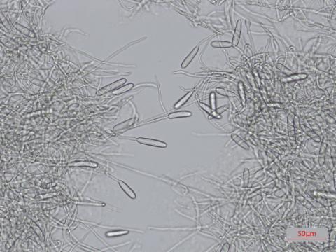 Cylindrocarpon_D34576_LQ