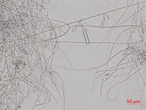 Cylindrocarpon_D44139_LQ