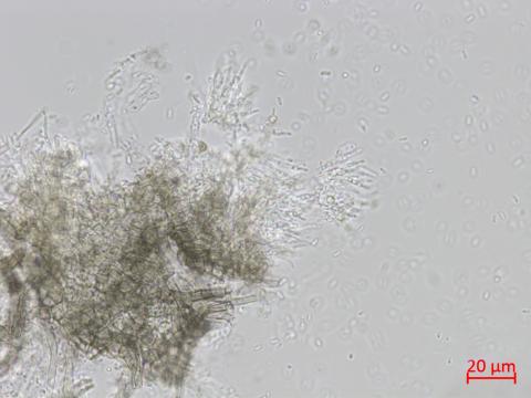 Cytospora_D47367-1_LQ