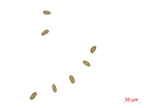 Diplodia_seriata_D45811_LQ