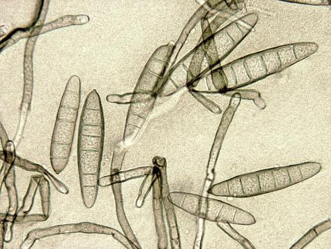 Exserohilum turcicum (Drechslera turcica)-01-ret