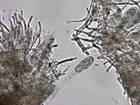 didymascella thujina-03-ret