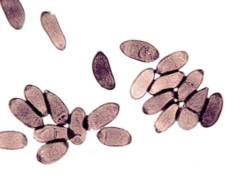 diplodia pinea-10-ret