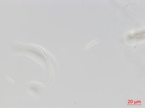 Fusarium_equiseti_2