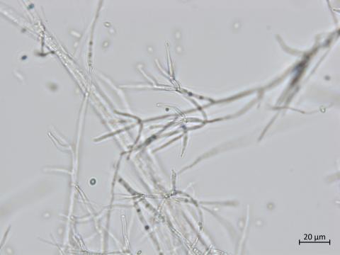 Gibellulopsis_sp_1