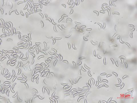 Gloeosporidiella_ribis_2