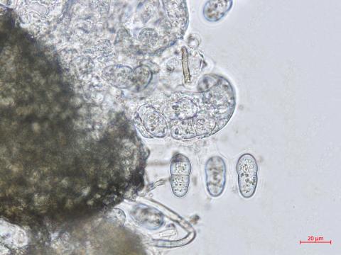 Leptosphaerulina_sp_3