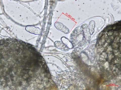 Leptosphaerulina_sp_4