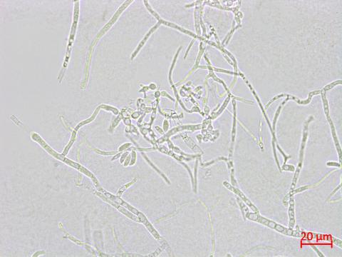 Microdochium_sp_2