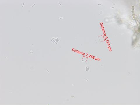 Phyllosticta_ampelicida_4