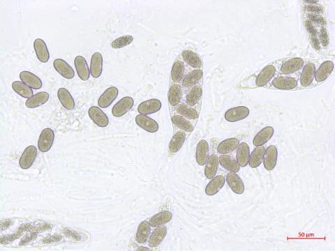 Physalospora_vaccinii_2