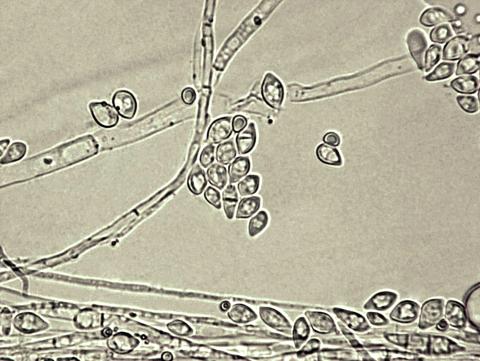Fusarium_tricinctum_2