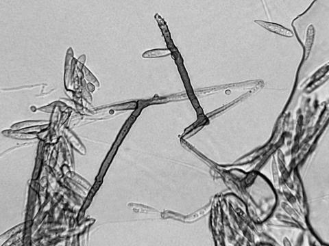 Helminthosporium_sp_2