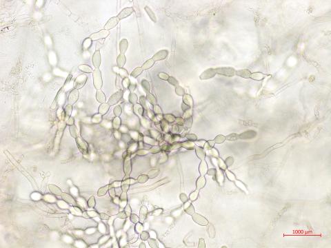 Rhizoctonia_solani_1