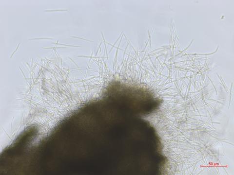 Septoria_sp_4