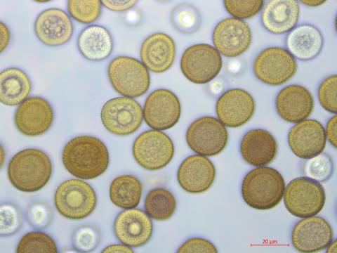 Tilletia_maclaganii_2