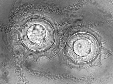 Pythium_mastophorum_1