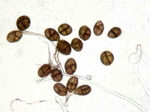 Ulocladium_sp_6