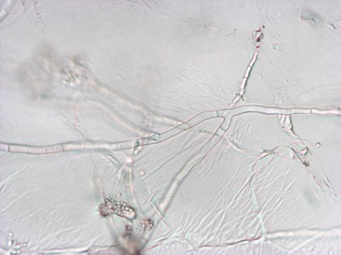 Sclerotium cepivorum