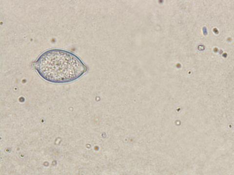 Phytophthora infestans - sporange