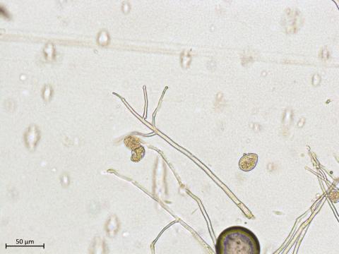 Phytophthora infestans - sporange