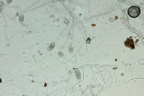 Phytophthora infestans