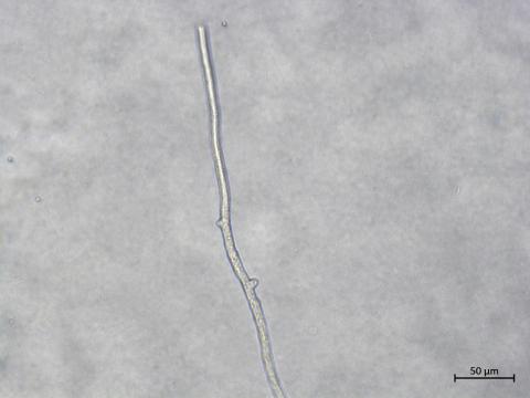 Aphanomyces_euteiches_3