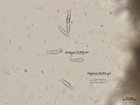 Botryosphaeria_dothidea_3