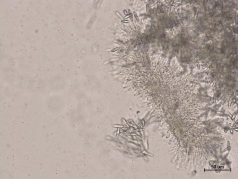 Botryosphaeria_dothidea_1