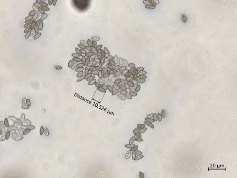 Coniella_diplodiella_3