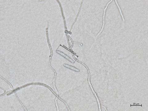 Dactylonectria_torresensis_1