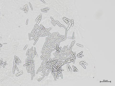Dactylonectria_torresensis_2