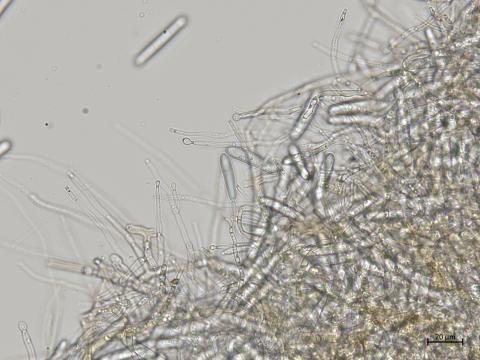 Dactylonectria_torresensis_3