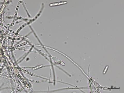 Dactylonectria_torresensis_4