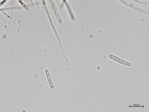 Dactylonectria_torresensis_5