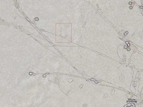 Fusarium_oxysporum_10