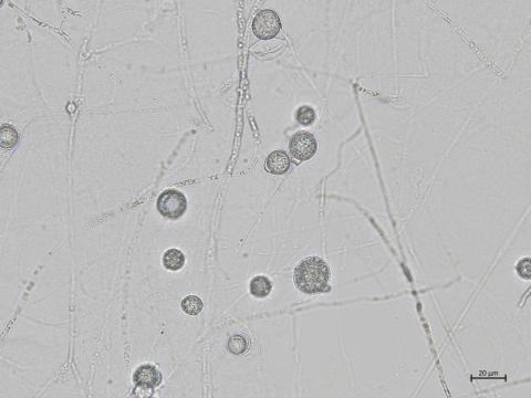 Globisporangium_irregulare_3