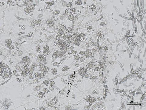 Neocosmospora_solani_3