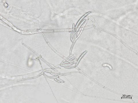 Neocosmospora_solani_5